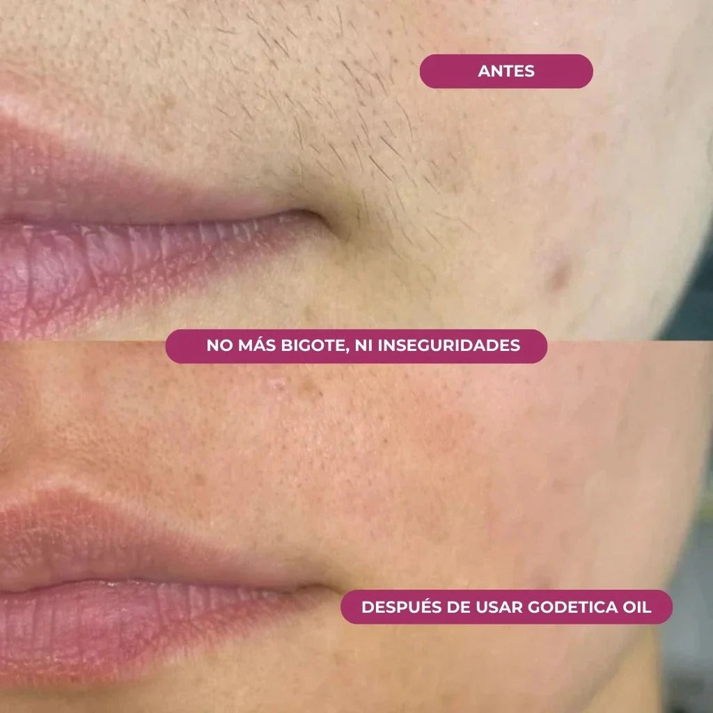 Aceite Godetica™ - Menos Vello, Más Suavidad