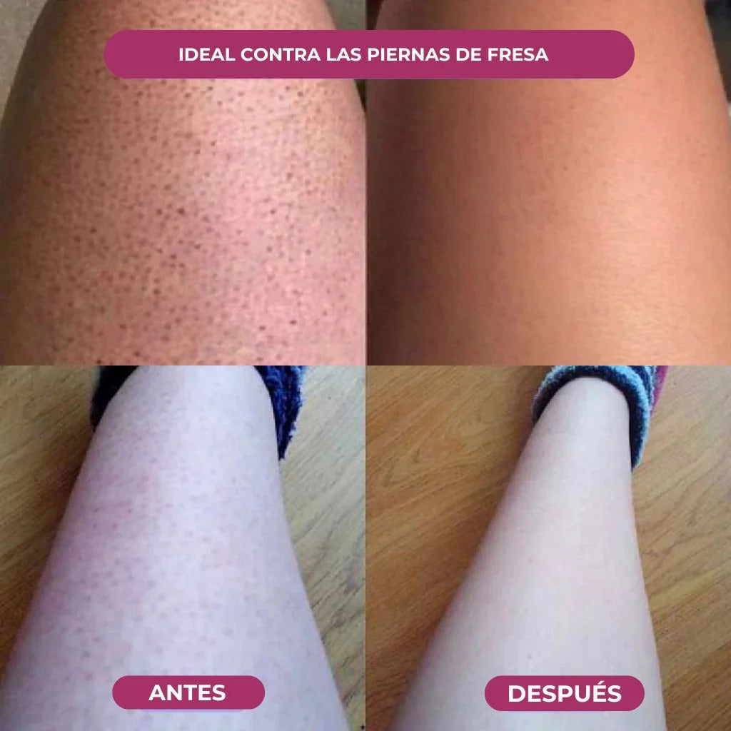 Aceite Godetica™ - Menos Vello, Más Suavidad